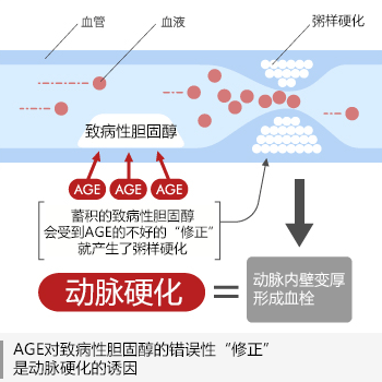 動脈硬化の引き金は悪玉コレステロールへのAGEの悪玉修飾